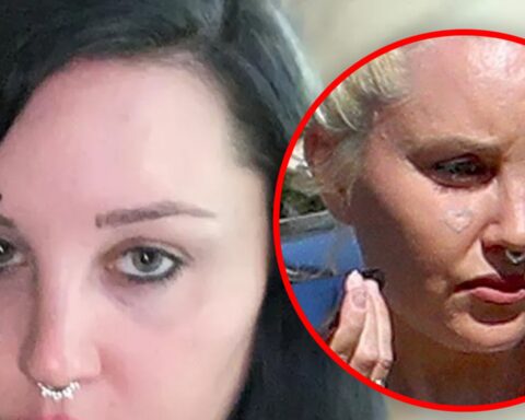 Amanda Bynes Appears to Be Removing Face Tattoo After Mental Health Center Check-In