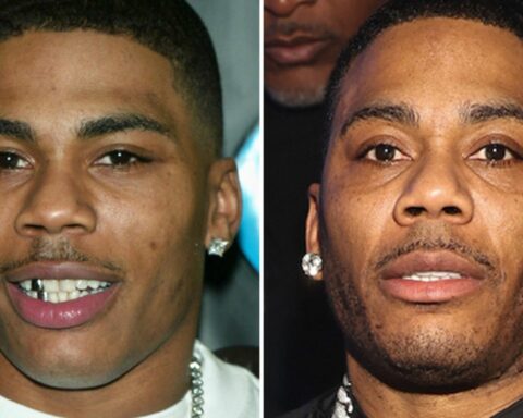 Nelly -- Good Genes Or Good Docs?!