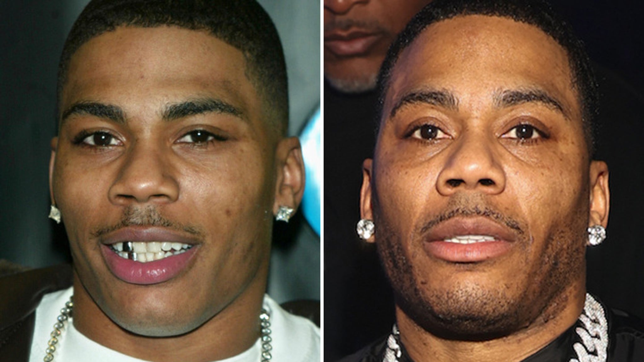 Nelly -- Good Genes Or Good Docs?!